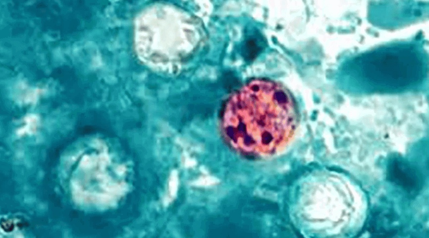 The five cases in Mississippi have been reported from residents ranging from the Delta to the Gulf Coast. UMMC is urging residents to cook vegetables and fruit as well as wash them thoroughly before consuming them raw.